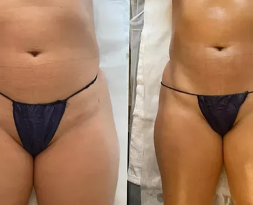 Body Luxe Day Spa - Image 5